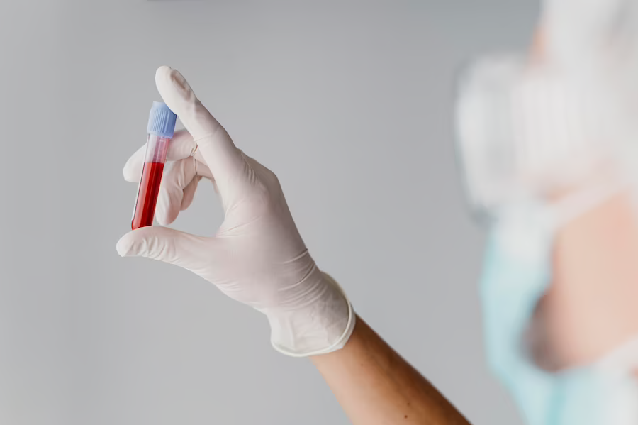 Medical-gloved hand holding a tube with a blood sample